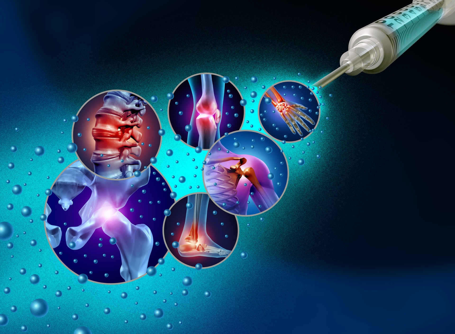 Regenerative Joint Pain Medicine